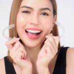 invisalign success stories in Calgary